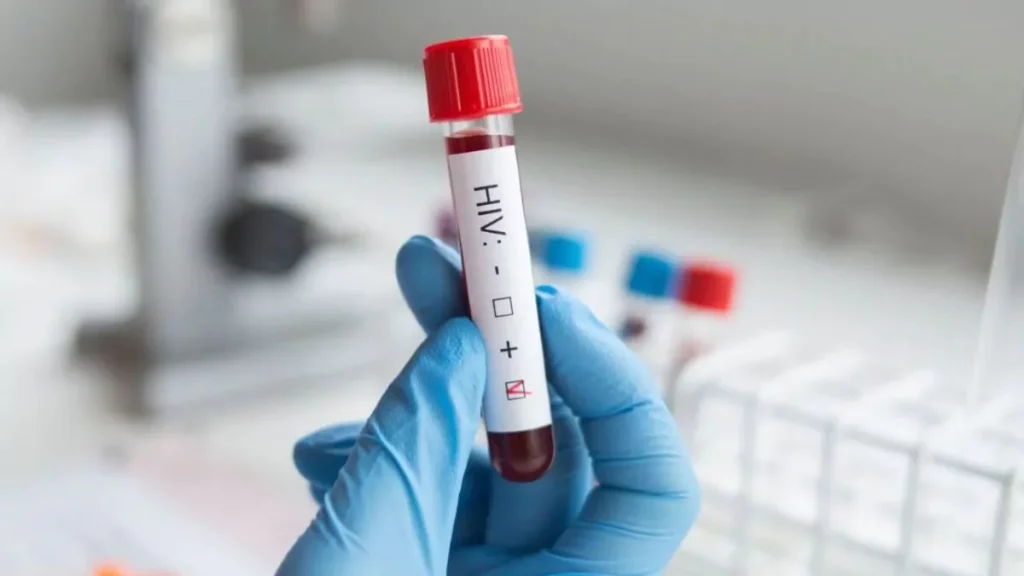 Un trasplante de células madre logra la curación del VIH en el décimo paciente